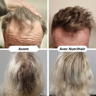 Huile Capillaire Régénérante de Batana - NutriHair™